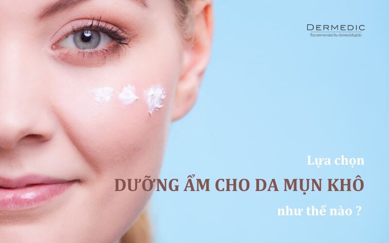 Cách dưỡng ẩm cho da mụn khô như thế nào? Tìm hiểu tầm quan trọng