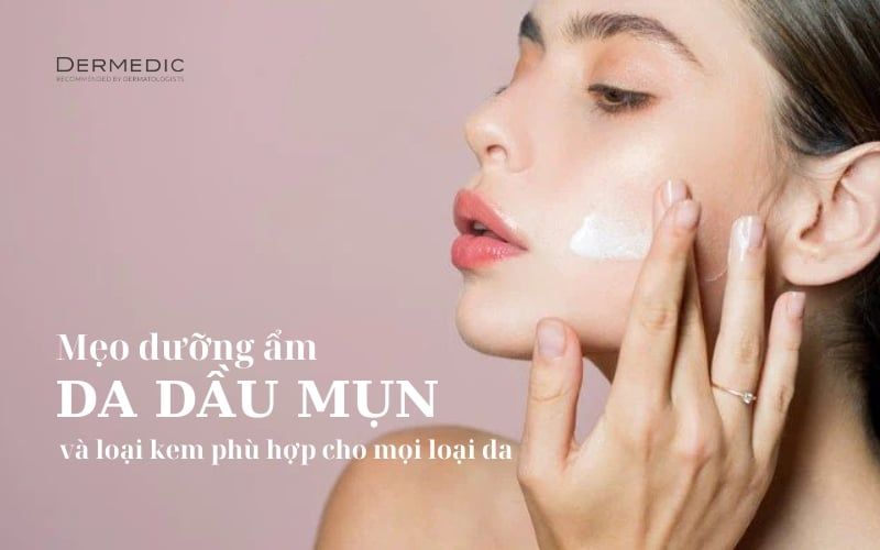 Mẹo dưỡng ẩm cho da dầu mụn và loại kem phù hợp cho mọi loại da