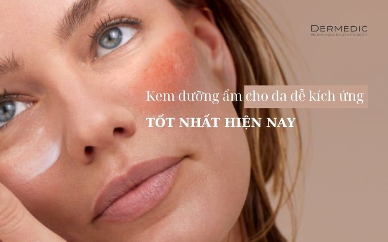 Sản phẩm kem dưỡng ẩm cho da dễ kích ứng tốt nhất hiện nay