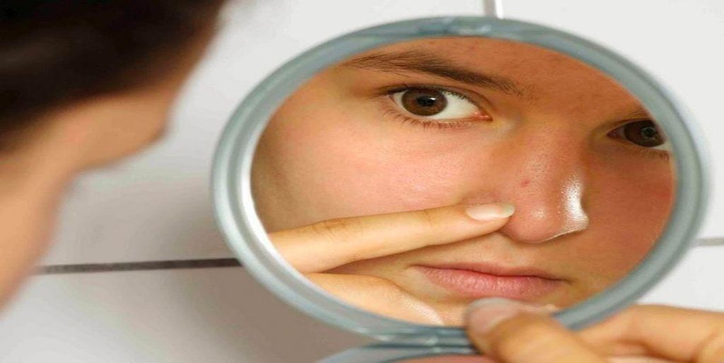 Tìm hiểu kem dưỡng ẩm cho da mụn đầu đen chất lượng tốt hiện nay