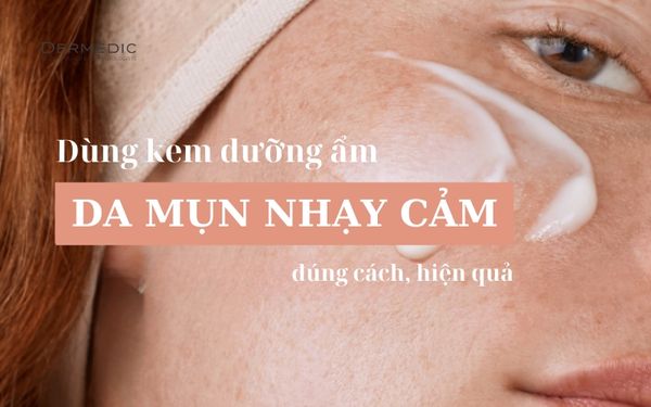 Nên Sử Dụng Kem Dưỡng Ẩm Cho Da Mụn Nhạy Cảm Hay Không?