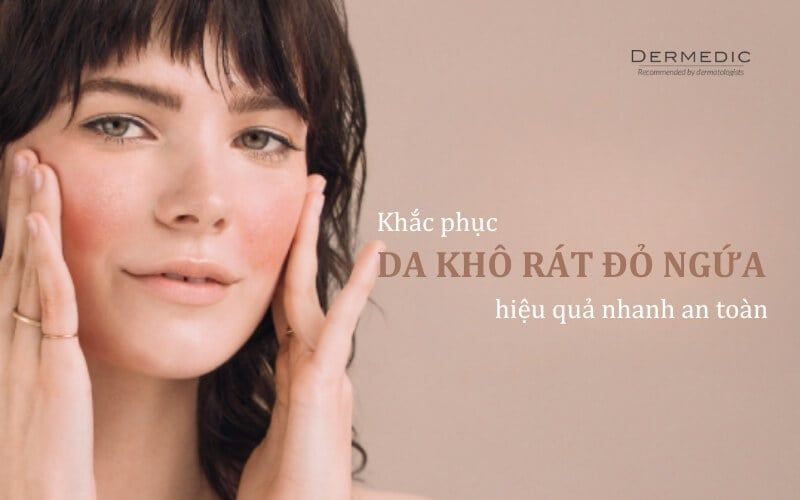 Khắc phục da khô rát đỏ ngứa hiệu quả nhanh an toàn qua từng bước