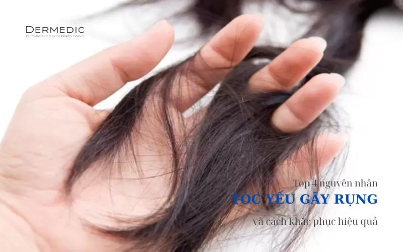 TOP 4 NGUYÊN NHÂN DỄ MẮC PHẢI KHIẾN TÓC BẠN YẾU VÀ GÃY RỤNG