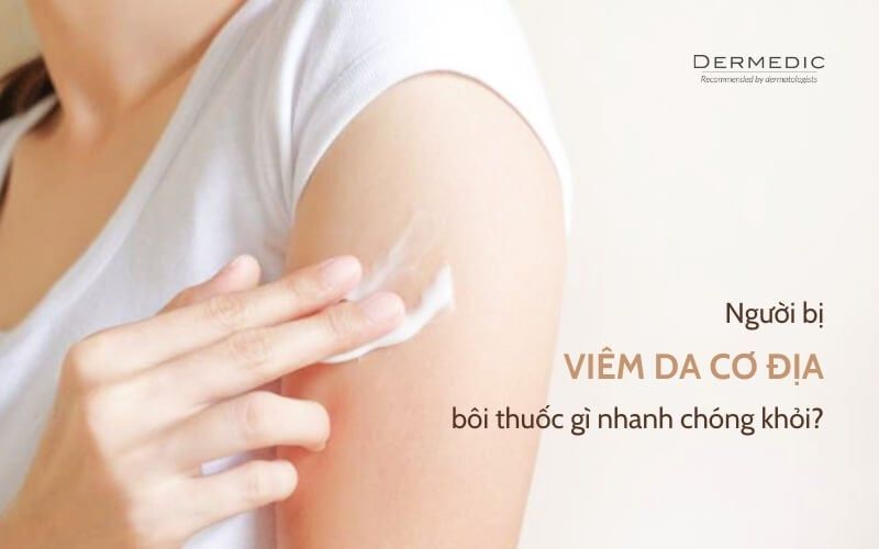 Người bị viêm da cơ địa bôi thuốc gì nhanh chóng khỏi?