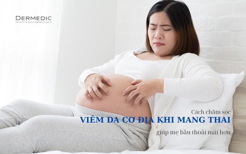 Viêm da cơ địa khi mang thai: Cách chăm sóc giúp mẹ bầu thoải mái hơn