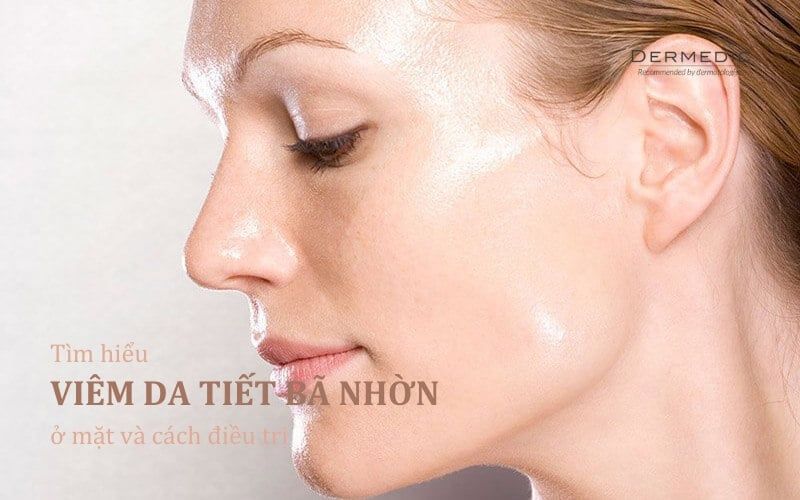 Tìm hiểu viêm da tiết bã nhờn ở mặt và cách điều trị