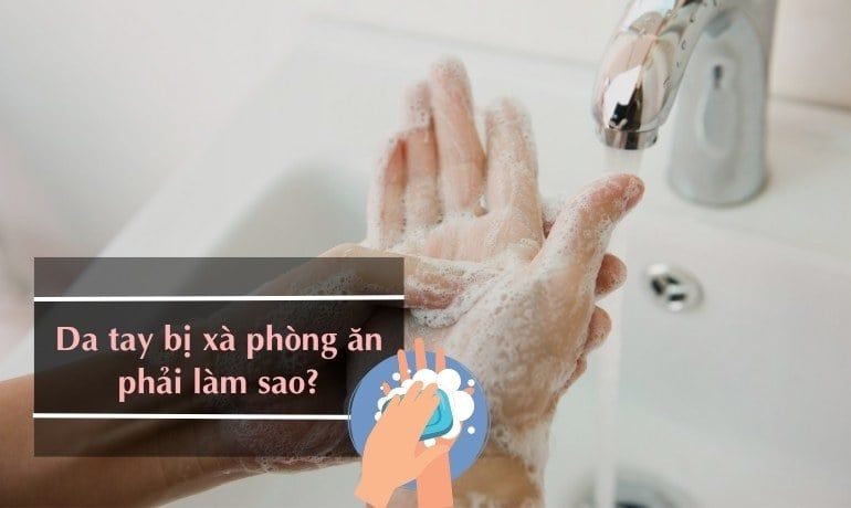 TAY BỊ XÀ PHÒNG ĂN PHẢI LÀM SAO? NGUYÊN NHÂN VÀ CÁCH XỬ LÝ