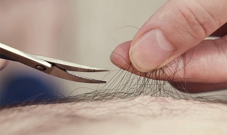 Tỉa lông vùng kín nữ bằng kéo có sao không? Cách làm tại nhà