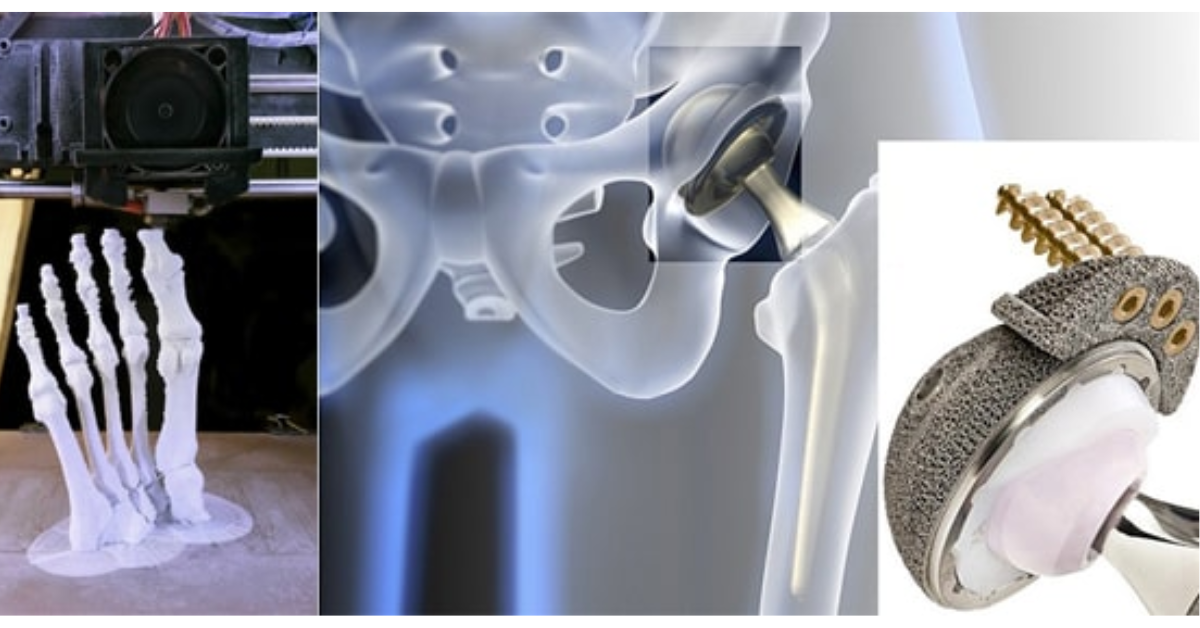 In 3D trong y học và những ứng dụng trong ngành y tế In 3D trong y học và những ứng dụng trong ngành y tế