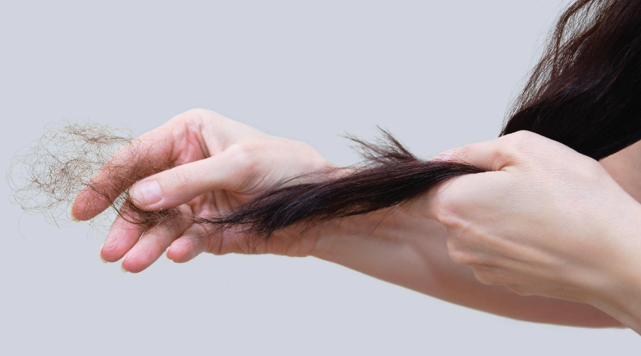 top-dau-goi-tri-rung-toc-1