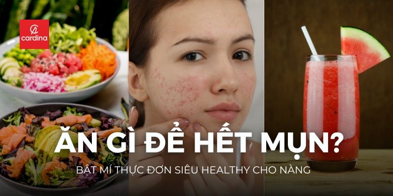 Ăn Gì Để Hết Mụn? Bật Mí Thực Đơn Siêu Healthy Cho Nàng