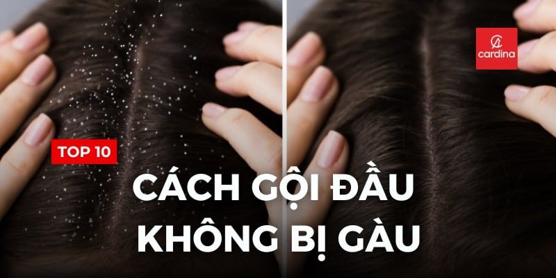 Top 10 Cách Gội Đầu Không Bị Gàu, Giúp Bạn Tự Tin Tỏa Sáng Mọi Khoảnh Khắc
