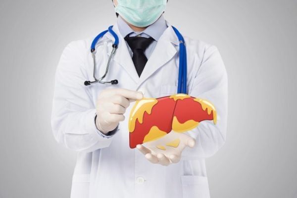 Gan nhiễm mỡ độ 1 là gì? Cách phát hiện và điều trị an toàn và hiệu quả