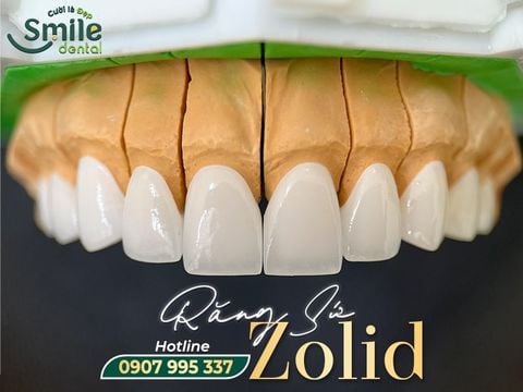 Dịch vụ phục hình bọc sứ thẩm mỹ Ceramill Zolid là gì? Giá của răng sứ có đắt không?