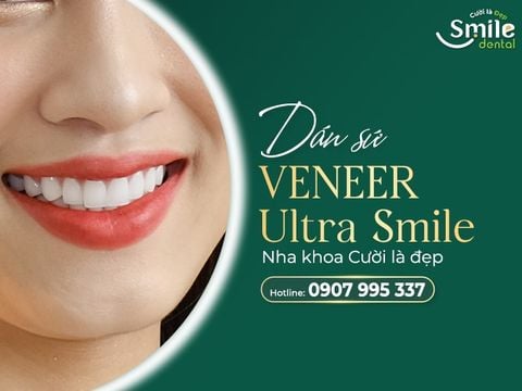 Dán răng sứ Veneer Ultra Smile - Nha khoa Cười là đẹp