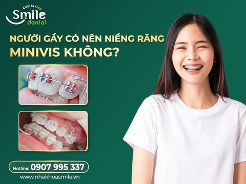 Người gầy có nên niềng răng thẩm mỹ MiniVis không?