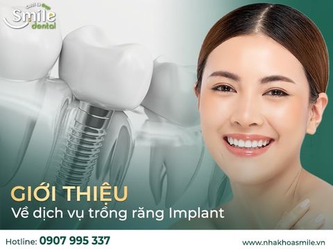 Giới thiệu về dịch vụ trồng răng implant