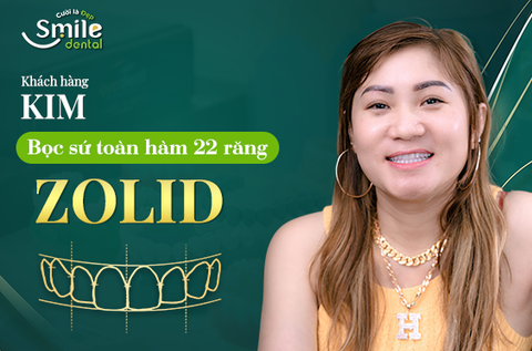 Chị Kim làm trọn bộ 22 răng sứ cao cấp tại nha khoa Smile.