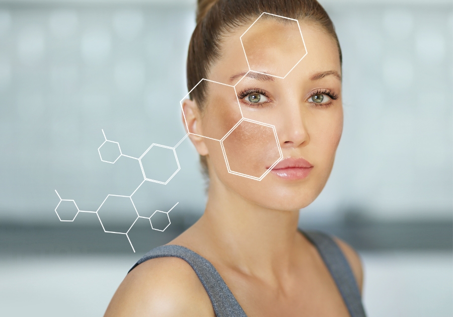 [Giải đáp] Thành phần nào trị nám nhanh hơn? – Dr. Baumann VN