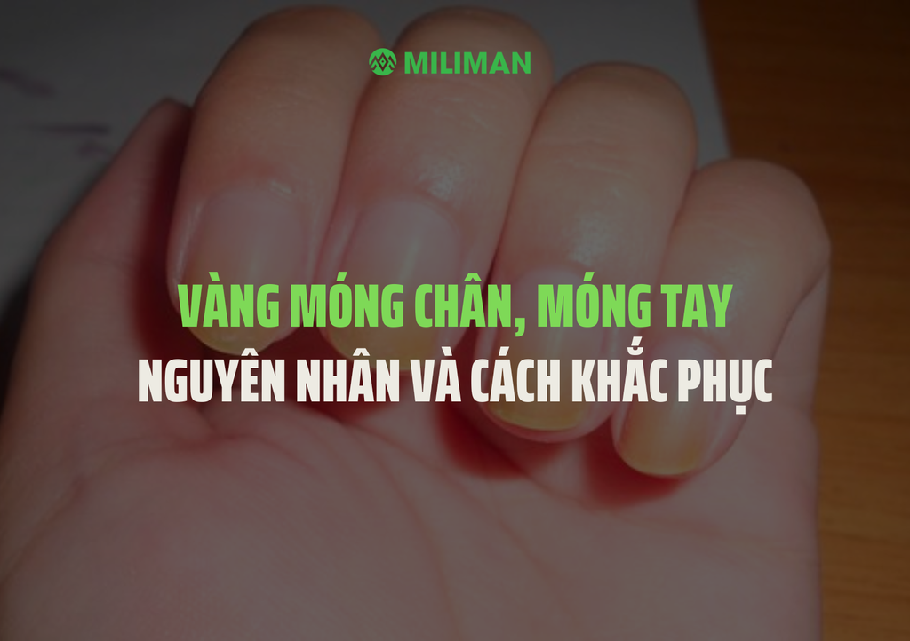 Vàng móng chân, móng tay - Nguyên nhân và cách khắc phục