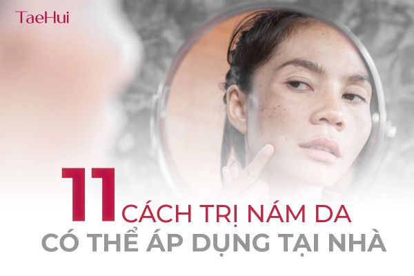11 phương pháp điều trị nám da tại nhà an toàn và hiệu quả