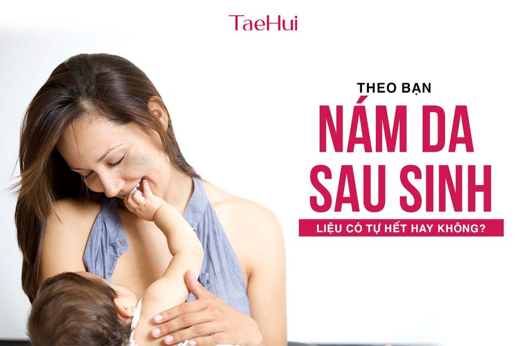 Theo bạn, nám da sau sinh liệu có tự hết hay không?