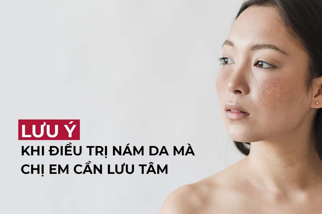 Những lưu ý khi điều trị nám da mà chị em cần lưu tâm để đạt hiệu quả tốt nhất