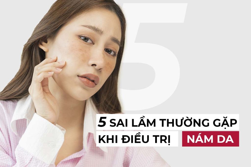 Bóc Phốt 5 Sai Lầm Khi Điều Trị Nám