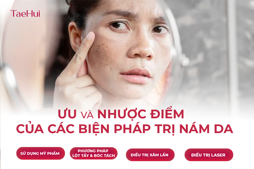 Ưu và nhược điểm của các biện pháp trị nám da hiện nay