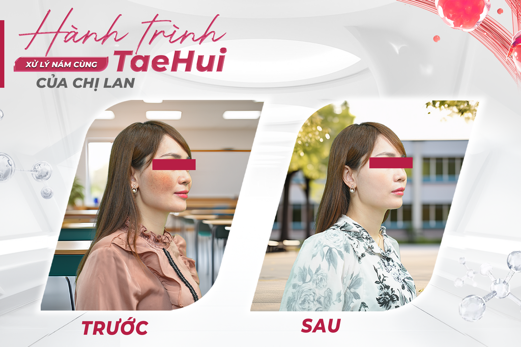 Hành Trình Mờ Nám Khoa Học Của Chị Lan Cùng TaeHui