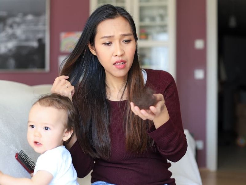 nguyen-nhan-rung-toc-sau-sinh