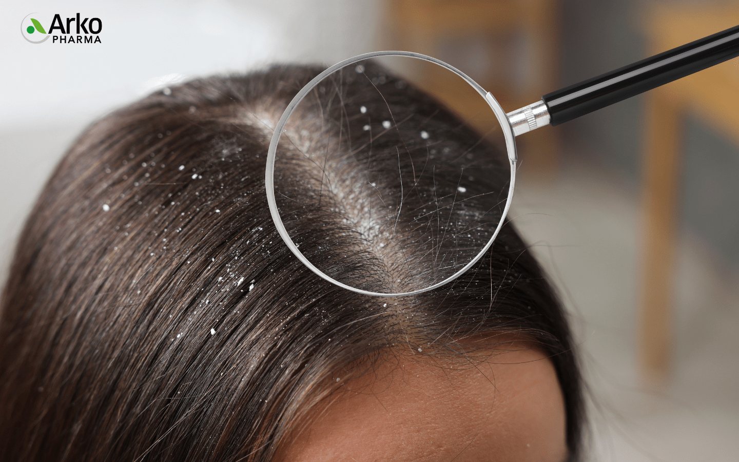 cham-soc-rieng-cho-mai-toc-hu-ton