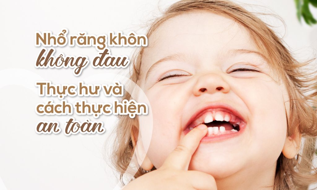 Nhổ răng khôn không đau: Thực hư và cách thực hiện an toàn