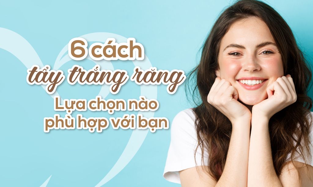 6 cách tẩy trắng răng: Lựa chọn nào phù hợp với bạn?