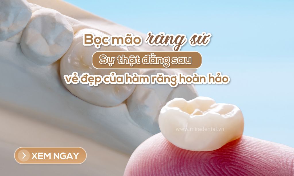 Bọc mão răng sứ có đau không? Sự thật đằng sau vẻ đẹp của hàm răng hoàn hảo