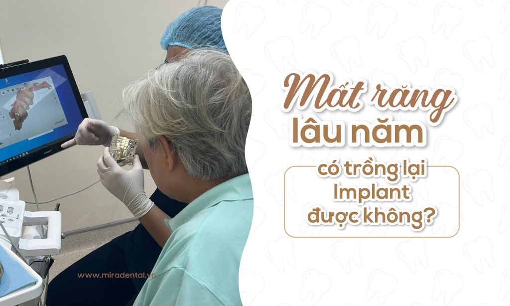 Mất răng lâu năm có trồng lại Implant được không?