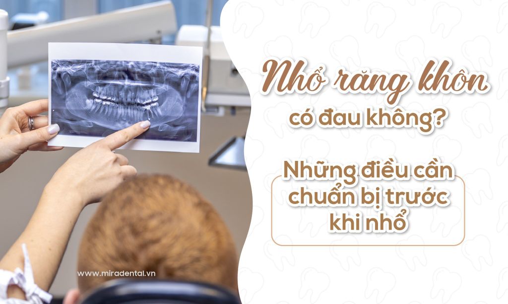 Nhổ răng khôn có đau không? Những điều cần chuẩn bị trước khi nhổ