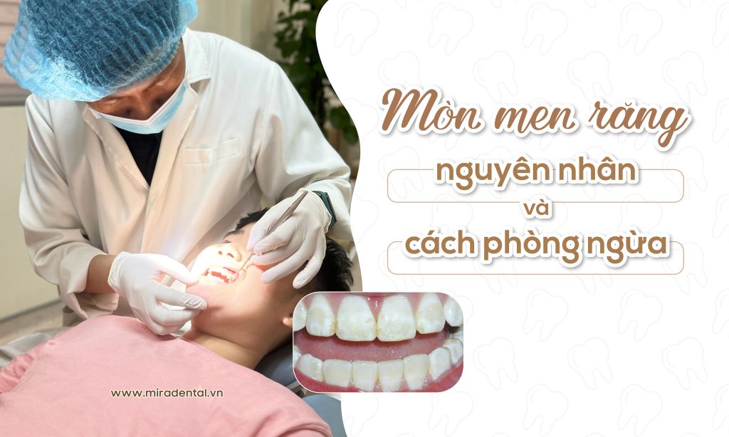 Nguyên Nhân Gây Mòn Men Răng Và Cách Phòng Ngừa