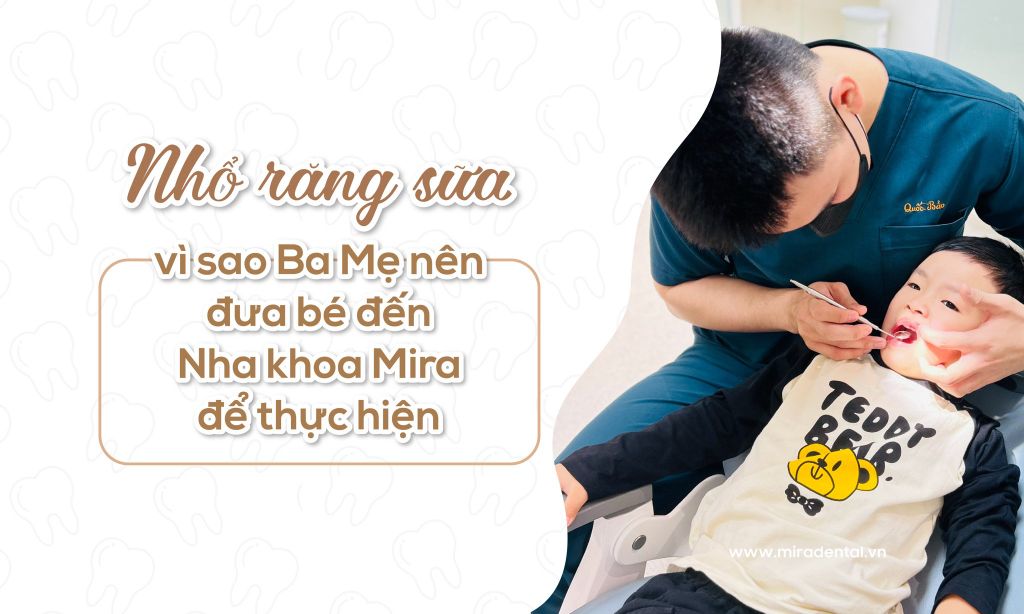 Vì Sao Nên Đưa Trẻ Đến Nha Khoa Mira Để Nhổ Răng Sữa?