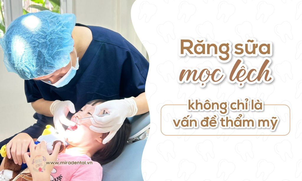 Răng sữa mọc lệch: Không chỉ là vấn đề thẩm mỹ