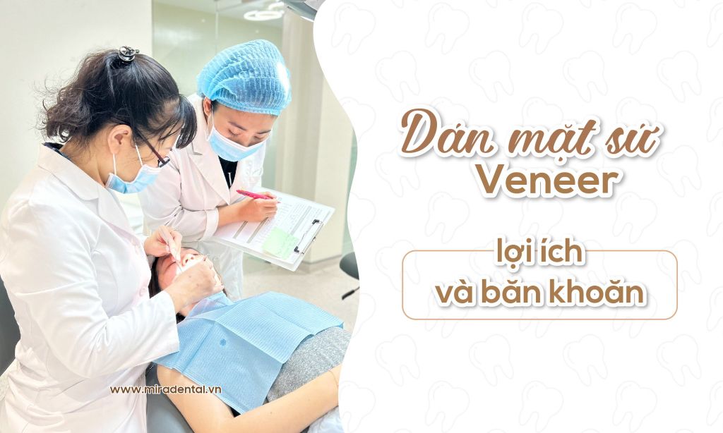 Có nên dán mặt răng sứ không? Giải đáp thắc mắc và lợi ích