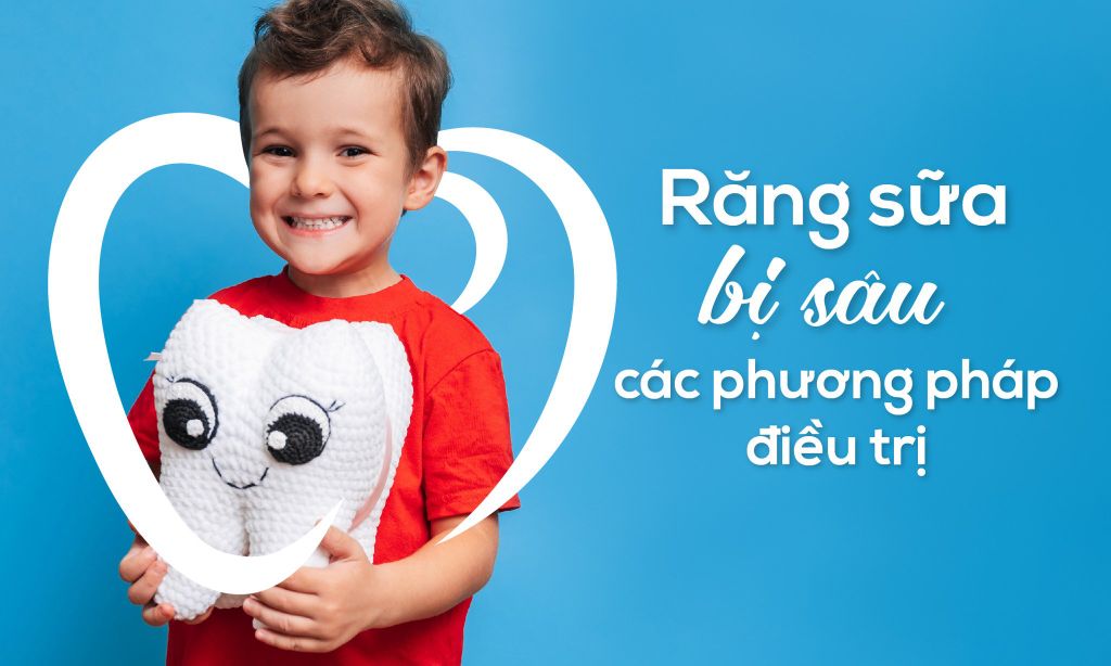 Răng sữa bị sâu và các phương pháp điều trị