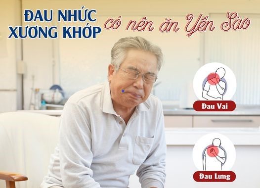 ĐAU NHỨC XƯƠNG KHỚP CÓ NÊN ĂN YẾN SÀO?
