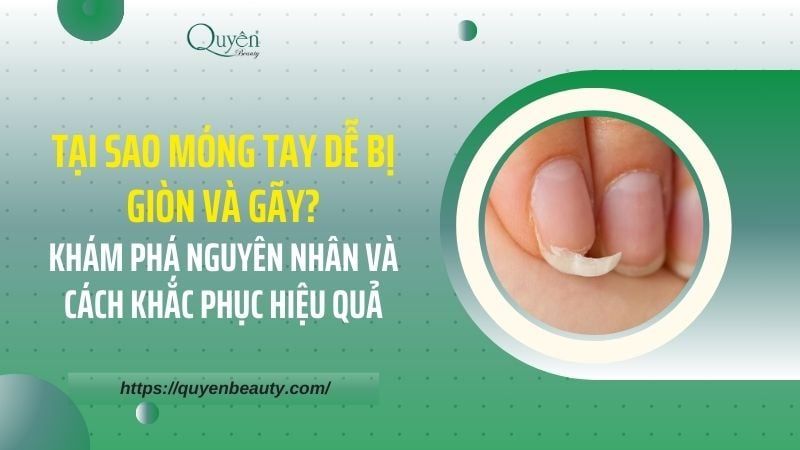 Tại Sao Móng Tay Dễ Bị Giòn Và Gãy? Khám Phá Nguyên Nhân Và Cách Khắc Phục Hiệu Quả