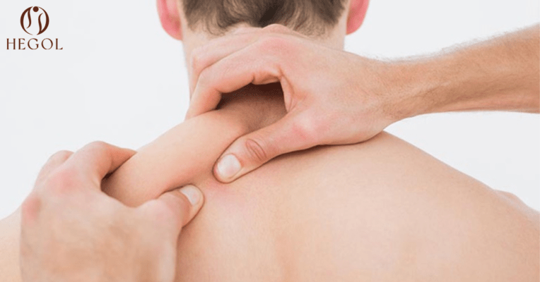 Các huyệt vùng vai gáy hỗ trợ trị liệu sức khỏe - Giảm đau nhức mỏi