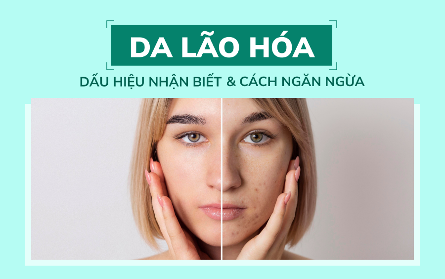 Da lão hóa - Dấu hiệu nhận biết - Cách ngăn ngừa