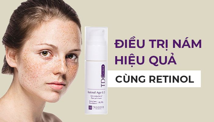 Trị nám bằng Retinol có hiệu quả không?