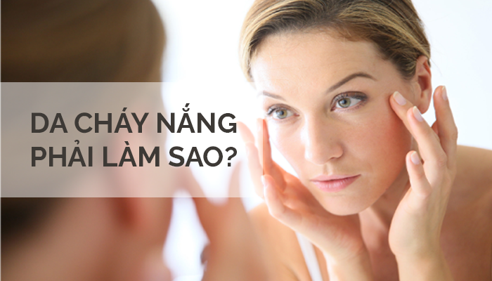Da bị cháy nắng phải làm sao? Cách khắc phục hiệu quả nhất 2023