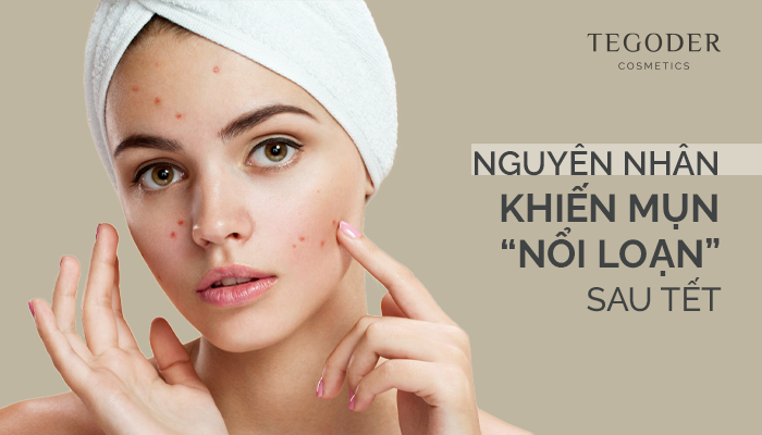 NGUYÊN NHÂN KHIẾN MỤN NỔI LOẠN SAU TẾT?