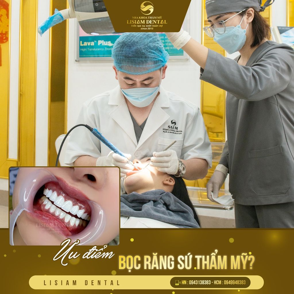Top 4 trường hợp bắt buộc phải nhổ răng